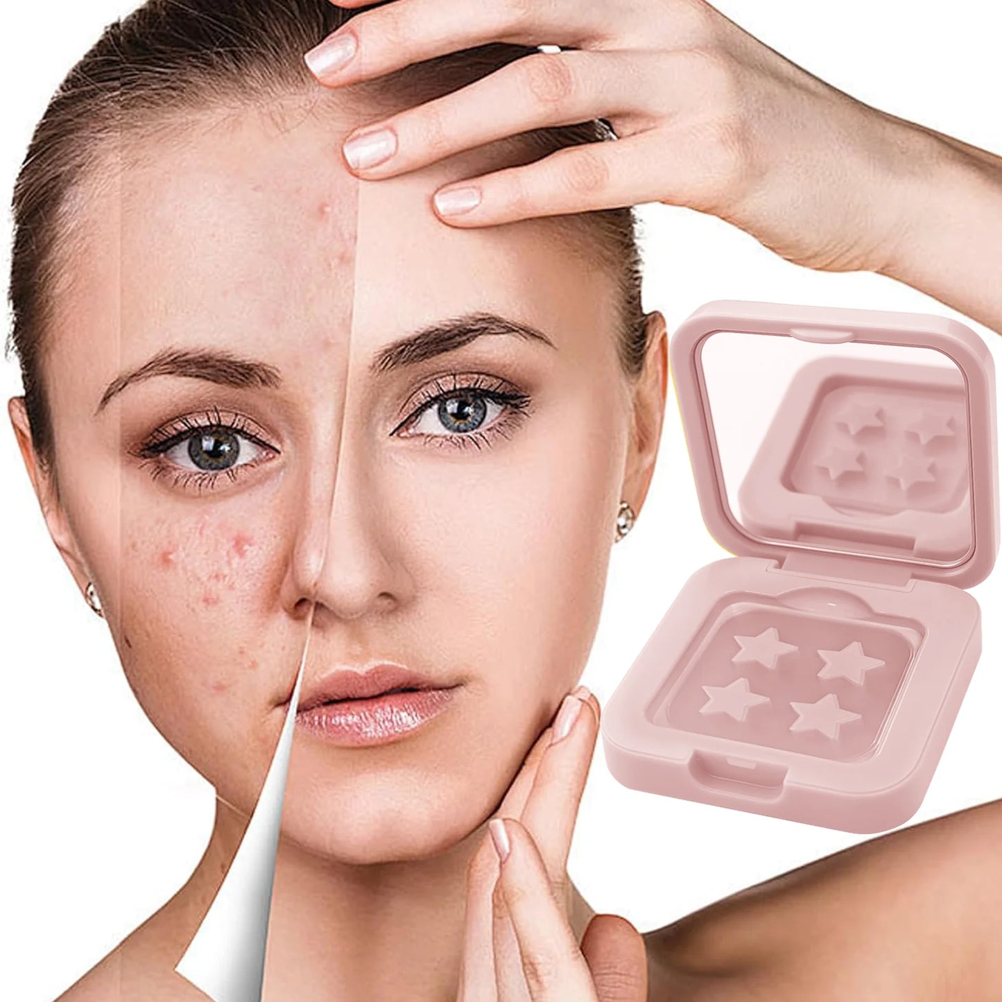 60 Acne Patch