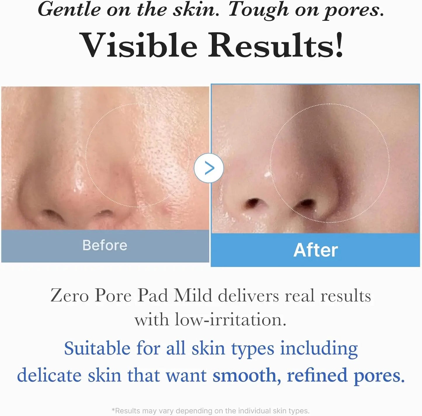 medicube Toner Pads Zero Pore Pad 2.0 Facial Pad for Exfoliation and Pore Care with AHA Lactic Acid  Acid Korean Skin Care