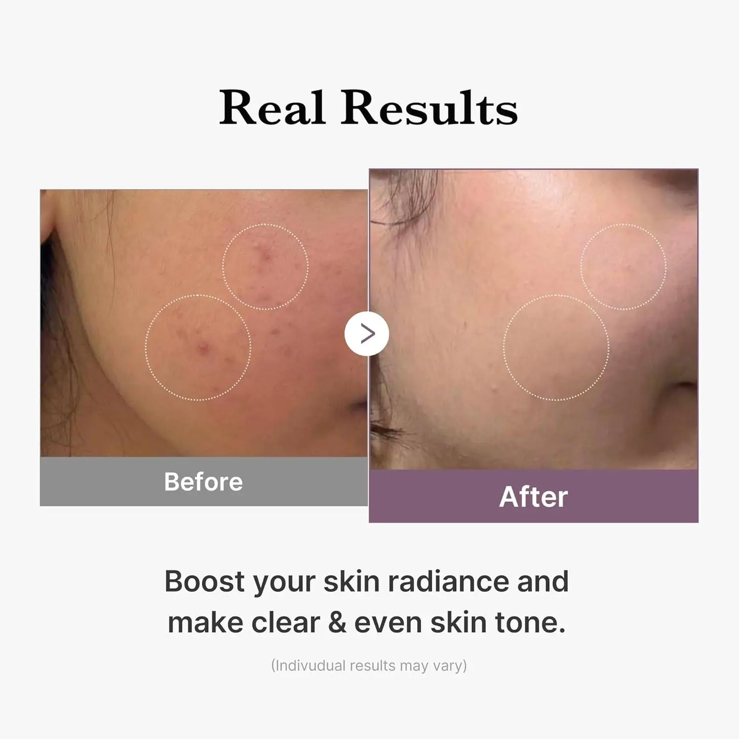 medicube Age-R Glutathione Glow Milky Toner Low-Irritation Double  for Glass Glow Even Skin Tone, Radiance Korean Skincare