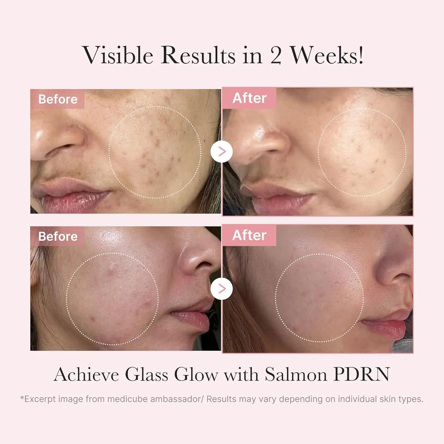 medicube Salmon DNA PD&RN Trial Kit Glass Glow Mini Skincare Set with Toner Serum Korean Skincare