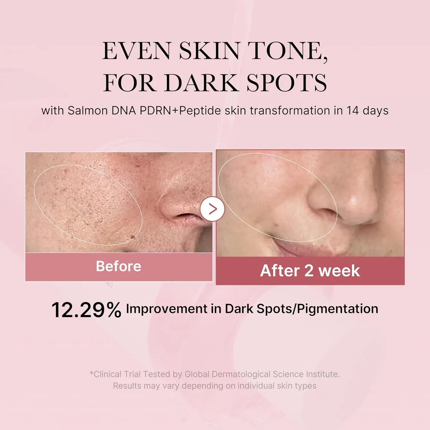 medicube PDRN Toner Salmon DNA PDRN CICA Soothing Toner Lightweight Watery for Skin Boosting Soothing Calming Uneven Skin Tone