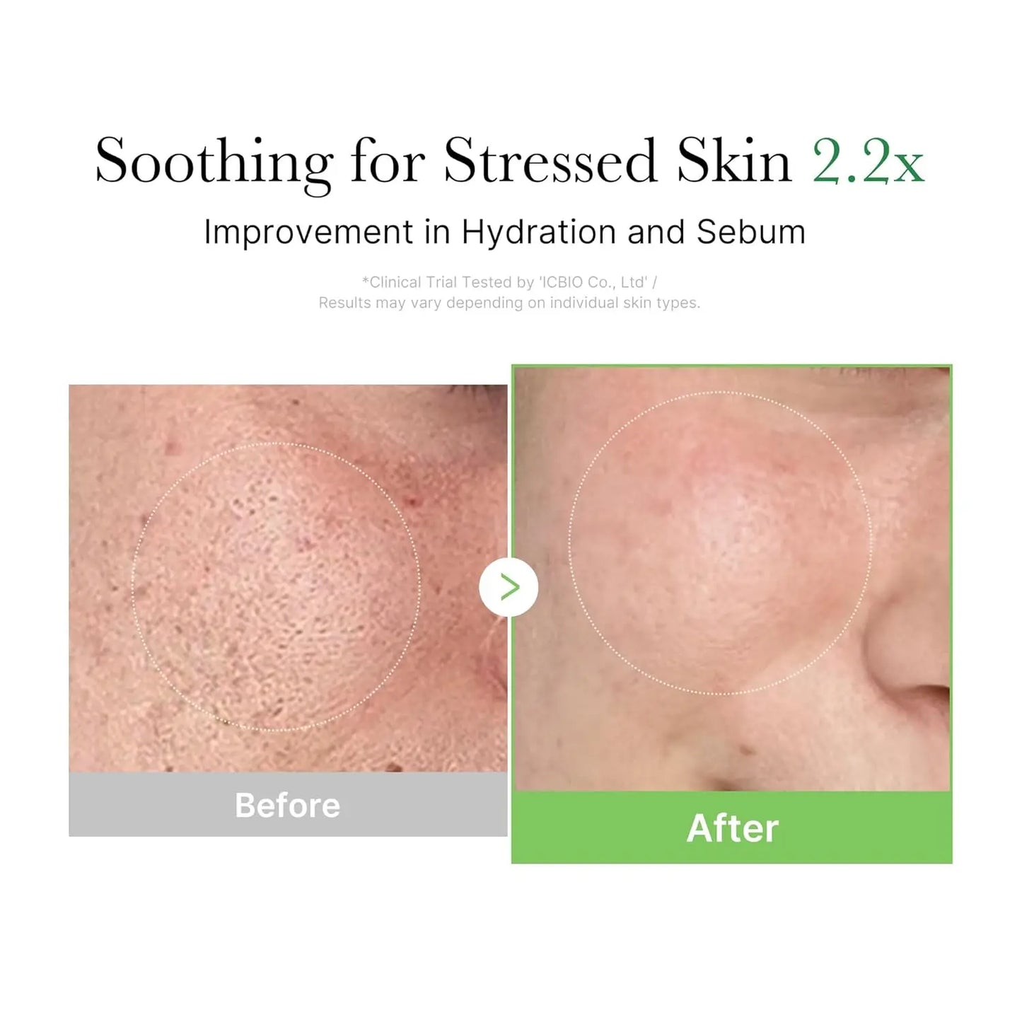medicube  Tea Tree Cream for Sensitive Skin with  Help Reduce Redness and Breakouts Low-irritating Moisturizing  Care