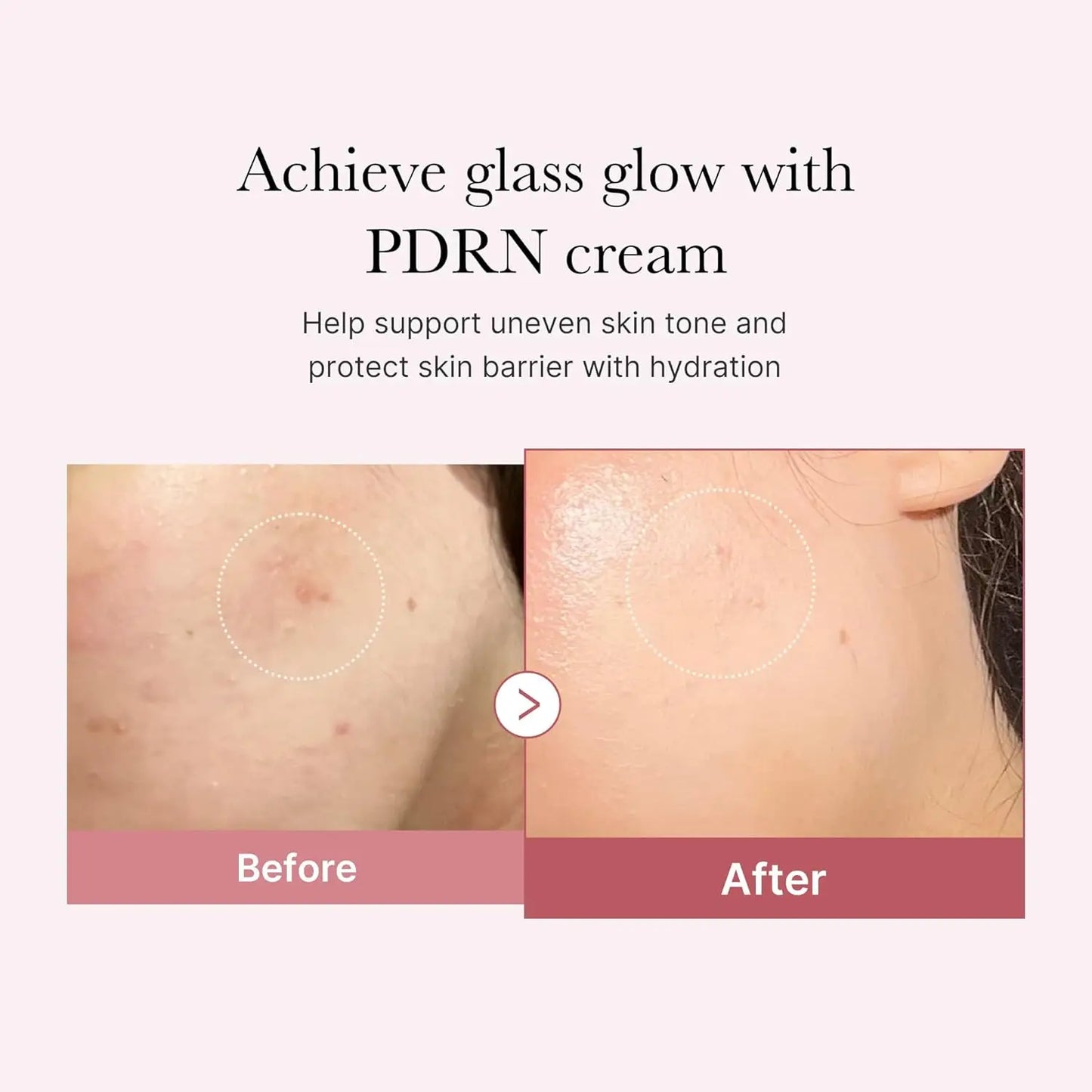 medicube PD RN Pink Moisturizing Cream Blemish Recovery Relief Hydrating Care Restores Skin Care for Even Skin Tone & Pore Care