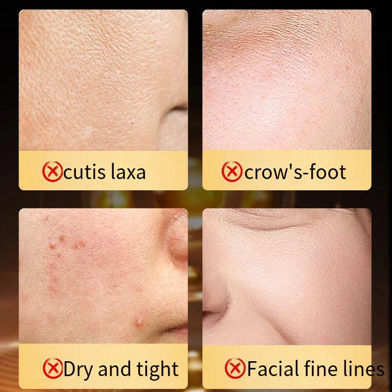 Best Salmon DNA Results Korean Skincare   Hydrating Serum Collagen Peptide Face Lifting Egf Anti Aging Dark Spot Wrinkle Removal
